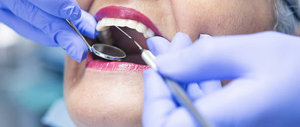 Best Emergency Dentist for Knocked-Out Tooth in Glendale, MS